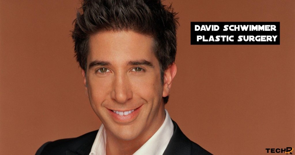 david schwimmer plastic surgery